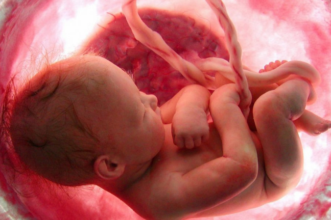 Phá thai là nguyên nhân gây tử vong hàng đầu trên toàn cầu năm 2021